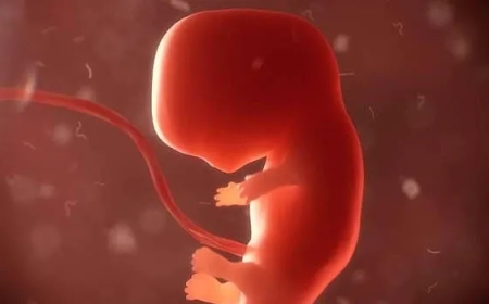 മുപ്പതുകാരിയുടെ കരളിനുള്ളിൽ മൂന്നുമാസം പ്രായമുള്ള ഭ്രൂണം.