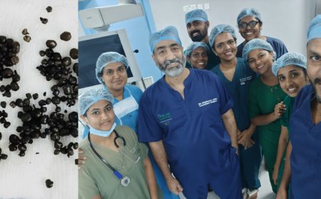 വീട്ടമ്മയുടെ പിത്താശയത്തിൽ നിന്ന് നീക്കിയത് 222 കല്ലുകൾ.