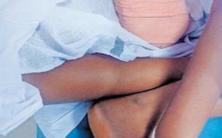 പാലക്കാട്ടെ ചികിത്സാ പിഴവ്; രണ്ടു ഡോക്ടർമാർക്ക് സസ്പെൻഷൻ.