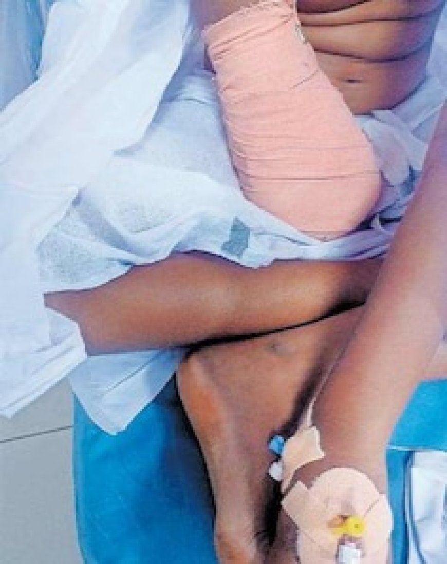 പാലക്കാട്ടെ ചികിത്സാ പിഴവ്; രണ്ടു ഡോക്ടർമാർക്ക് സസ്പെൻഷൻ.