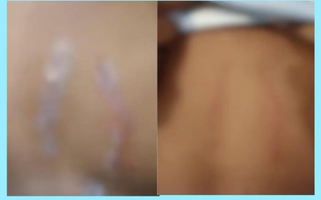 അമ്മയുടെ കൂടെ കിടന്നതിന് 12 വയസ്സുകാരനെ ക്രൂരമായി മർദ്ദിച്ച അമ്മയുടെ സുഹൃത്തും, അമ്മയും അറസ്റ്റിൽ.