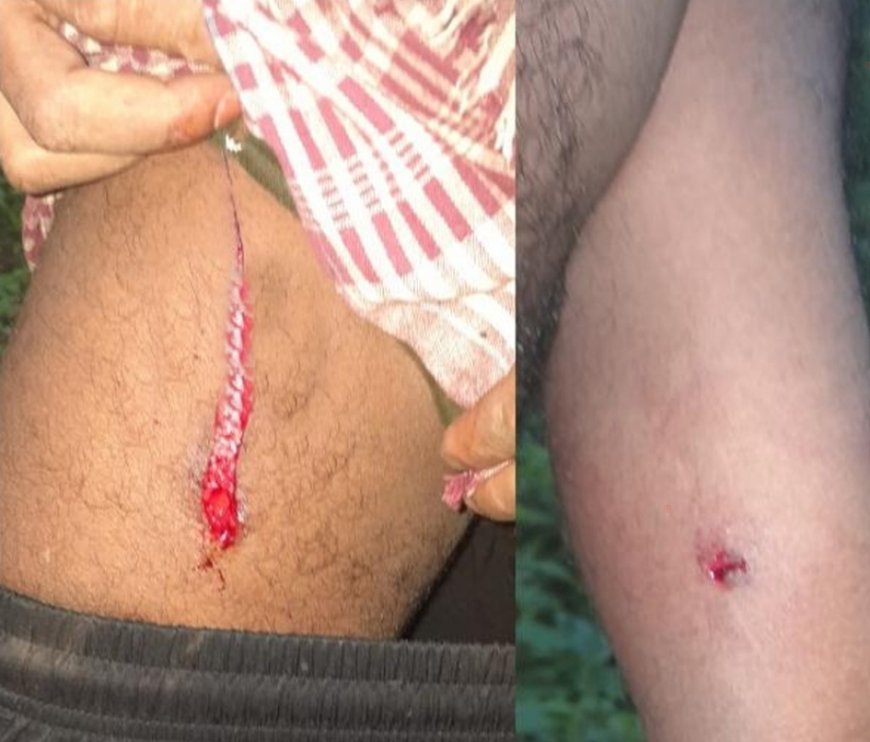 കാട്ടുപന്നിയുടെ കുത്തേറ്റ് ടാപ്പിംഗ് തൊഴിലാളിക്ക് പരിക്ക്